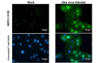 Immunocytochemistry/ Immunofluorescence Zika virus NS5 Antibody - BSA Free