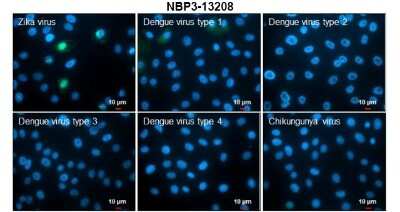 Immunocytochemistry/Immunofluorescence: Zika virus NS5 Antibody [NBP3-13208] - Immunofluorescent analysis of arboviruses infected cells using Zika virus NS5 antibody (NBP3-13208). Samples: EUROIMMUN Arboviral Fever Mosaic 2 slide (FR 2668-1010-1). Green: Zika virus NS5 antibody (NBP3-13208) diluted at 1:500. Blue: Hoechst 33342 staining. Scale bar = 10 um.