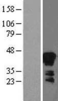 Western Blot: Zinc Alpha 2 Glycoprotein Overexpression Lysate (Adult Normal) [NBL1-07871] Left-Empty vector transfected control cell lysate (HEK293 cell lysate); Right -Over-expression Lysate for Zinc Alpha 2 Glycoprotein.