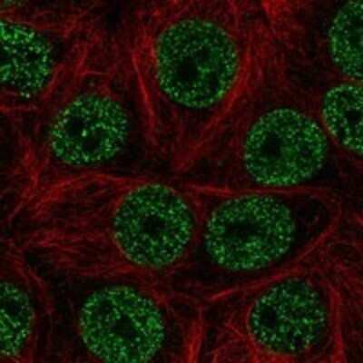 Immunocytochemistry/Immunofluorescence: Zinc finger and BTB domain-containing protein 9 Antibody [NBP3-17965] - Staining of human cell line MCF7 shows localization to nucleoplasm.
