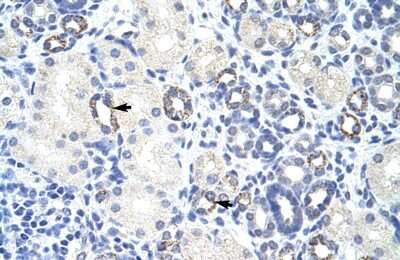 Immunohistochemistry: Zinc finger and BTB domain-containing protein 9 Antibody [NBP2-88629] - Human kidney