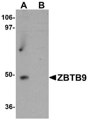 Western Blot Zinc finger and BTB domain-containing protein 9 Antibody - BSA Free