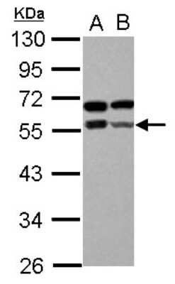 Western Blot: Zinc finger and BTB domain-containing protein 9 Antibody [NBP2-20956] - Sample (30 ug of whole cell lysate) A: IMR32 B: U87-MG 10% SDS PAGE gel, diluted at 1:1000.