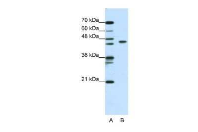 Western Blot: Zinc finger and BTB domain-containing protein 9 Antibody [NBP2-88629] - WB Suggested Anti-ZBTB9 Antibody Titration: 0.2-1 ug/ml. ELISA Titer: 1:312500. Positive Control: Jurkat cell lysate