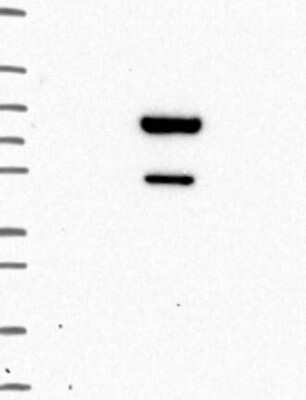 Western Blot Zinc finger and BTB domain-containing protein 9 Antibody - BSA Free