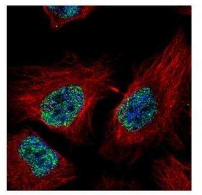 Immunocytochemistry/Immunofluorescence: Zinc finger protein 287 Antibody [NBP2-20957] - Confocal immunofluorescence analysis of paraformaldehyde-fixed HeLa, using ZNF287 antibody (Green) at 1:500 dilution. Alpha-tubulin filaments are labeled with Alpha-tubulin antibody (Red) at 1:2000.