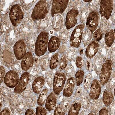 Immunohistochemistry-Paraffin: Zinc finger protein 287 Antibody [NBP1-82360] - Staining of human kidney shows strong cytoplasmic positivity in cells in tubules.