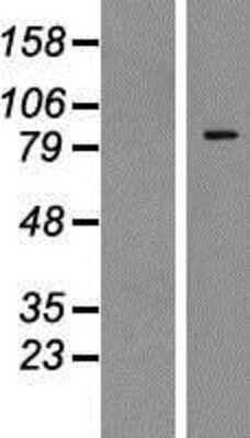 Western Blot: Zinc finger protein 287 Overexpression Lysate (Adult Normal) [NBP2-06608] Left-Empty vector transfected control cell lysate (HEK293 cell lysate); Right -Over-expression Lysate for Zinc finger protein 287.
