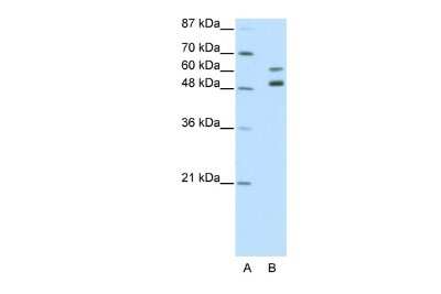 Western Blot: Zinc finger protein 682 Antibody [NBP2-83806] - WB Suggested Anti-ZNF682 Antibody Titration: 2.5ug/ml. ELISA Titer: 1:12500. Positive Control: Jurkat cell lysate