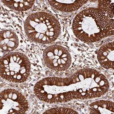 Immunohistochemistry: Zinc finger protein 790 Antibody [NBP2-31625] - Staining of human colon shows strong cytoplasmic and membranous positivity in glandular cells.
