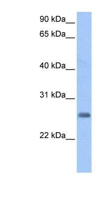 Western Blot: Zinc finger protein pseudogene Antibody [NBP1-91382] - HepG2 cell lysate, concentration 0.2-1 ug/ml.