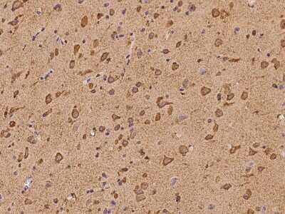 Immunohistochemistry-Paraffin: Zinc transporter 9 Antibody [NBP2-97935] - Immunochemical staining of human Zinc transporter 9 in human brain with rabbit polyclonal antibody at 1:200 dilution, formalin-fixed paraffin embedded sections.