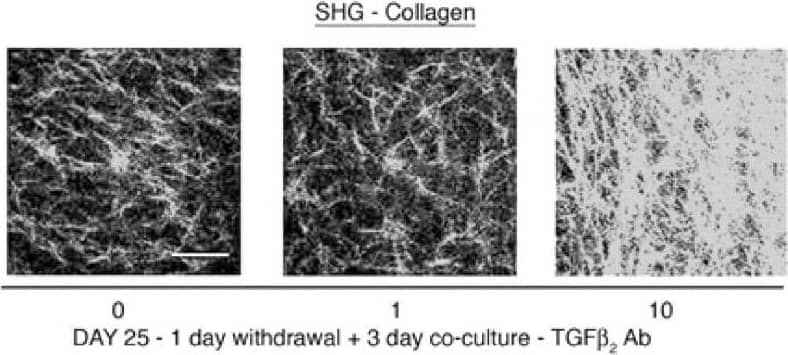 Quantification of soluble collagen content in the media&matrix. (C, D) Representative Second harmonic generated (SHG) images (scale bar = 50 μm) of collagen fibrils at day 25 are shown along with the quantification of signal intensities. The SHG signals from the collagen secreted by NHLF embedded in rat tail collagen gels which co-cultured with the IL-13 pre-treated NHBE at 10 ng/ml are elevated compared to the untreated NHBE co-culture; * p < 0.01&this increase is inhibited on incubation with TGF beta 2 neutralizing antibody in the 3 day co-culture period (§ p < 0.01 compared to respective condition without TGF beta 2 antibody). Addition of goat IgG did not alter the increased levels of collagen in the matrix&media in the pre-treated NHBE-NHLF co-culture. Image collected & cropped by CiteAb from the following open publication (//respiratory-research.biomedcentral.com/articles/10.1186/1465-9921-9-27), licensed under a CC-BY license. Not internally tested by R&D Systems.