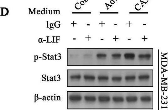 LIF neutralizing antibody inhibits the migration and invasion capability and the Stat3 phosphorylation induced by CAA-CM on breast cancer cells. (A and B) MDA-MD-231 cells cultured in Adi-CM or CAA-CM or control DMEM were treated with LIF neutralizing antibody/IgG. The cell migration (A) and invasion (B) situation were monitored under a phase contrast microscope. The corresponding quantization chart is shown on the right. (C) MDA-MB-231 cells were treated with different culture media for 15 min, and Stat3 phosphorylation was analyzed by western blot. (D) MDA-MD-231 cells cultured in DMEM or Adi-CM or CAA-CM were treated with LIF neutralizing antibody or IgG for 15 min, and Stat3 phosphorylation was analyzed by western blot. Typical microscopic fields and blots are shown and quantitative data are presented as mean ± SD from at least three independent experiments. #p < 0.05, ##p < 0.01, ###p < 0.001, CAA-CM VS. Mock; *p < 0.05, **p < 0.01, ***p < 0.001, CAA-CM +  alpha -LIF VS. CAA-CM. Image collected and cropped by CiteAb from the following open publication (//pubmed.ncbi.nlm.nih.gov/35280694), licensed under a CC-BY license. Not internally tested by R&D Systems.