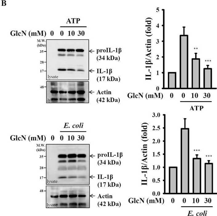 GlcN inhibits caspase-1 activation and the release of IL-1 beta , IL-18 and ASC. (A–D) J774A.1 macrophages were incubated for 4 h with LPS (1 µg/ml) followed by incubation for 2 h with GlcN. Cells were then incubated with ATP (5 mM, 0.5 h) or infected with E. coli (30 MOI, 1 h). The expression levels of IL-1 beta  and IL-18 (A), caspase-1 (C), ASC (D) in the supernatants and IL-1 beta  in the cell lysates (B) were analysed by Western blotting. (E) J774A.1 macrophages were incubated for 4 h with LPS (1 µg/ml) followed by incubation for 2 h with GlcN, D-(+)-glucose (Glu), D-glucosamine 3-sulphate (GlcN-3S), D-(+)-galactosamine hydrochloride (GalN) and N-acetyl-D-glucosamine (GlcNAc) for 2 h, followed by incubation with ATP (5 mM) for 0.5 h. The IL-1 beta  expression levels in the supernatants were measured by ELISA. (F) J774A.1 macrophages were incubated for 4 h with LPS (1 µg/ml) or PamsCSK4 (1 µg/ml; for non-canonical inflammasome) followed by incubation for 2 h with GlcN, followed by transfection with poly(dA/dT) (2 µg/ml) or LPS (2 µg/ml) for 6 h or by Salmonella infection (30 MOI) for 2 h. The IL-1 beta  expression levels in the supernatants were measured by ELISA. The ELISA data are expressed as the mean ± SD of separate experiments as indicated. The Western blotting results are representative of three different experiments and the histogram shows the quantification expressed as the mean ± SD for these three experiments. *, *** and **** indicate a significant difference at the level of p < 0.05, p < 0.001 and p < 0.0001, respectively, compared to NLRP3 activator-treated cells. (One-way ANOVA with Dunnett’s multiple comparisons test). The blots in (A–D) were cropped from different gels; full-length blots are included in the “Supplementary Information”. Image collected and cropped by CiteAb from the following open publication (//pubmed.ncbi.nlm.nih.gov/30944389), licensed under a CC-BY license. Not internally tested by R&D Systems.