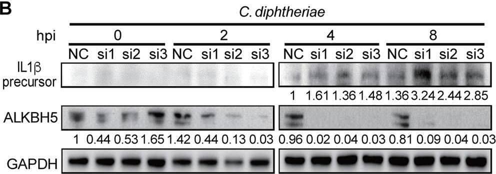 ALKBH5 regulates the expression of innate immune response genes during bacterial and viral infections in RAW264.7 cells. (A) ALKBH5 knockdown enhanced the expression levels of the IL-1 beta , CSF3, TGM2, and SRC transcripts during P. aeruginosa, C. diphtheriae, HSV-1, or HSV-1 ICP34.5 mutant infection. (B to D) ALKBH5 knockdown enhanced the protein level of IL-1 beta  during infection by C. diphtheriae (B), P. aeruginosa (C), or the HSV-1 ICP34.5 mutant (D). (E) ALKBH5 overexpression inhibited the expression of the IL-1 beta , CSF3, TGM2, and SRC genes during P. aeruginosa infection as measured by RT-qPCR. (F) ALKBH5 overexpression inhibited the protein level of IL-1 beta  during P. aeruginosa infection as measured by Western blotting. Image collected and cropped by CiteAb from the following open publication (//pubmed.ncbi.nlm.nih.gov/36625590), licensed under a CC-BY license. Not internally tested by R&D Systems.