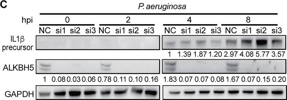 ALKBH5 regulates the expression of innate immune response genes during bacterial and viral infections in RAW264.7 cells. (A) ALKBH5 knockdown enhanced the expression levels of the IL-1 beta , CSF3, TGM2, and SRC transcripts during P. aeruginosa, C. diphtheriae, HSV-1, or HSV-1 ICP34.5 mutant infection. (B to D) ALKBH5 knockdown enhanced the protein level of IL-1 beta  during infection by C. diphtheriae (B), P. aeruginosa (C), or the HSV-1 ICP34.5 mutant (D). (E) ALKBH5 overexpression inhibited the expression of the IL-1 beta , CSF3, TGM2, and SRC genes during P. aeruginosa infection as measured by RT-qPCR. (F) ALKBH5 overexpression inhibited the protein level of IL-1 beta  during P. aeruginosa infection as measured by Western blotting. Image collected and cropped by CiteAb from the following open publication (//pubmed.ncbi.nlm.nih.gov/36625590), licensed under a CC-BY license. Not internally tested by R&D Systems.
