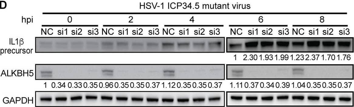 ALKBH5 regulates the expression of innate immune response genes during bacterial and viral infections in RAW264.7 cells. (A) ALKBH5 knockdown enhanced the expression levels of the IL-1 beta , CSF3, TGM2, and SRC transcripts during P. aeruginosa, C. diphtheriae, HSV-1, or HSV-1 ICP34.5 mutant infection. (B to D) ALKBH5 knockdown enhanced the protein level of IL-1 beta  during infection by C. diphtheriae (B), P. aeruginosa (C), or the HSV-1 ICP34.5 mutant (D). (E) ALKBH5 overexpression inhibited the expression of the IL-1 beta , CSF3, TGM2, and SRC genes during P. aeruginosa infection as measured by RT-qPCR. (F) ALKBH5 overexpression inhibited the protein level of IL-1 beta  during P. aeruginosa infection as measured by Western blotting. Image collected and cropped by CiteAb from the following open publication (//pubmed.ncbi.nlm.nih.gov/36625590), licensed under a CC-BY license. Not internally tested by R&D Systems.