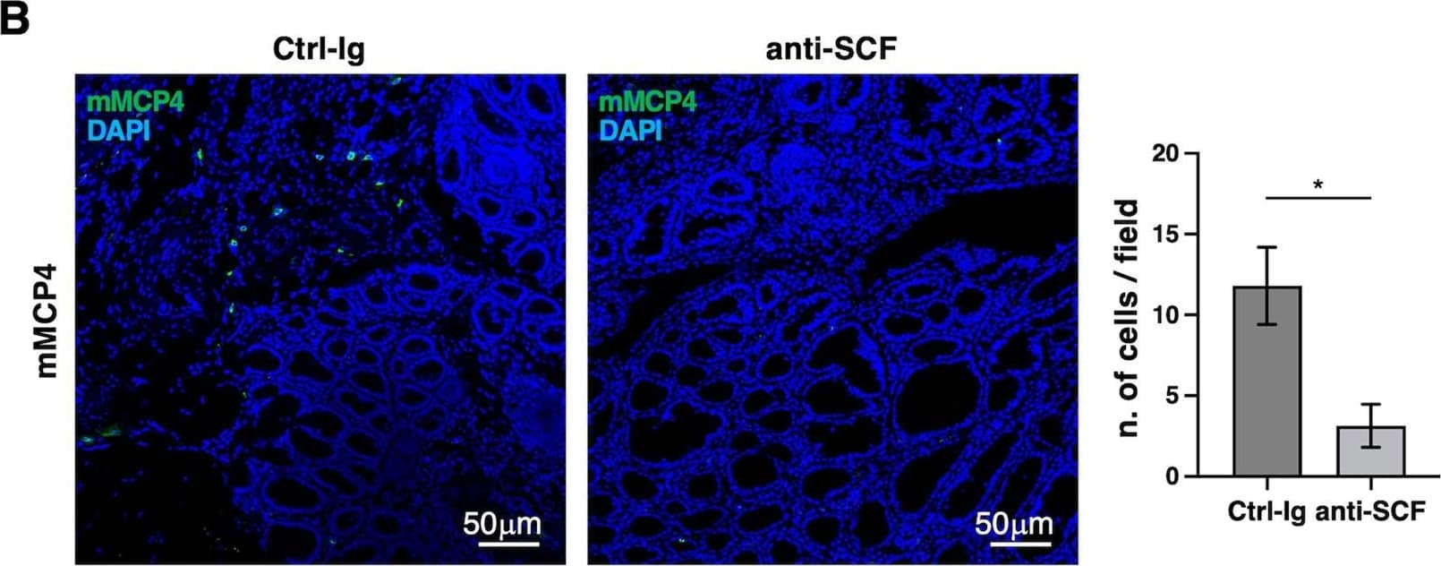 SCF controls connective tissue-like MC accumulation in tumor lesions. A Schematic representation of anti-SCF neutralizing Ab administration in vivo. AOM/DSS-treated mice were i.p. injected three times with anti-SCF or control Ab (100 μg/mouse) starting from the fourth DSS cycle. Treated and control mice were sacrificed at 13 weeks from AOM administration. B Colon paraffin-embedded sections from AOM/DSS mice treated with Ctrl-Ig or anti-SCF neutralizing antibodies as described in (A) were stained with anti-MCP4 Ab followed by Alexa Fluor 488 secondary Abs (green). Nuclei were counterstained with DAPI (blue) and images were acquired with a Zeiss LSM980 confocal microscopy using a 20× objective. The frequencies of MCs positive for mMCP4 protease were analyzed in 20 fields randomly acquired from tumor lesions and shown as mean ± SD cells/field. Paired Student’s t test: *p < 0.05. Number of adenomas and colon lengths are shown in (C). Paired Student’s t test: *p < 0.05. Graphs are representative of two independent experiments with a total of 5 mice/group. Image collected and cropped by CiteAb from the following open publication (//pubmed.ncbi.nlm.nih.gov/37730723), licensed under a CC-BY license. Not internally tested by R&D Systems.