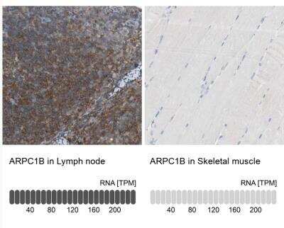 <b>Orthogonal Strategies Validation. </b>Immunohistochemistry-Paraffin: actin-related protein 2/3 complex subunit 1B Antibody [NBP1-90114] - Analysis in human lymph node and skeletal muscle tissues. Corresponding ARPC1B RNA-seq data are presented for the same tissues.