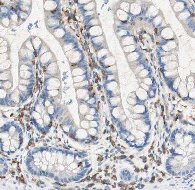 Immunohistochemistry-Paraffin: actin-related protein 2/3 complex subunit 1B Antibody [NBP1-90114] - Staining of human small intestine shows moderate cytoplasmic positivity in lymphoid cells.