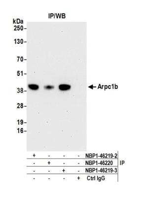 <b>Independent Antibodies Validation. </b>Immunoprecipitation: actin-related protein 2/3 complex subunit 1B Antibody [NBP1-46219] - Detection of human Arpc1b by western blot of immunoprecipitates. Samples: Whole cell lysate (1.0 mg per IP reaction; 20% of IP loaded) from HeLa cells prepared using NETN lysis buffer. Antibodies: Affinity purified rabbit anti-Arpc1b antibody NBP1-46219 (lot NBP1-46219-3) used for IP at 3 ug per reaction. Arpc1b was also immunoprecipitated by a previous lot of this antibody (lot NBP1-46219-2) and rabbit anti-Arpc1b antibody NBP1-46220. For blotting immunoprecipitated Arpc1b, A302-780A was used at 1 ug/ml. Detection: Chemiluminescence with an exposure time of 30 seconds.