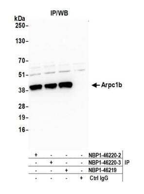 <b>Independent Antibodies Validation and Biological Strategies Validation.</b>Immunoprecipitation: actin-related protein 2/3 complex subunit 1B Antibody [NBP1-46220] - Detection of human Arpc1b by western blot of immunoprecipitates. Samples: Whole cell lysate (0.5 or 1.0 mg per IP reaction; 20% of IP loaded) from HeLa cells prepared using NETN lysis buffer. Antibodies: Affinity purified rabbit anti-Arpc1b antibody NBP1-46220 (lot NBP1-46220-3) used for IP at 6 ug per reaction. Arpc1b was also immunoprecipitated by a previous lot of this antibody (lot NBP1-46220-2) and rabbit anti-Arpc1b antibody NBP1-46219. For blotting immunoprecipitated Arpc1b, NBP1-46220 was used at 1 ug/ml. Detection: Chemiluminescence with an exposure time of 30 seconds.