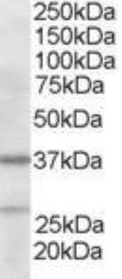 Western Blot: actin-related protein 2/3 complex subunit 1B Antibody [NB300-898] - Staining (2 ug/ml) of Human Liver lysate (RIPA buffer, 35 ug total protein per lane). Primary incubated for 1 hour. Detected by chemiluminescence.