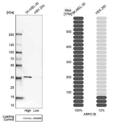 Western Blot: actin-related protein 2/3 complex subunit 1B Antibody [NBP1-90114] - Analysis in human cell lines SK-MEL-30 and HEK293 using anti-ARPC1B antibody. Corresponding ARPC1B RNA-seq data are presented for the same cell lines. Loading control: anti-HDAC1.