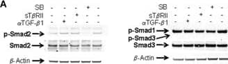 Effect of Alk4-/Alk5-inhibition on Smad-phosphorylation under TGF-beta -free conditions (A) Western blot of p-Smad2, 1, 3 of PC cultured for 24 hrs under complete serum-free conditions and subjected to Alk4/5 Inhibitor (SB-431542, 5 μM), rsT beta RII (1 μg/ml) and neutralizing anti TGF-beta 1 antibody (4 μg/ml), respectively. Lysates were probed for p-Smad2, p-Smad1, and p-Smad3, total Smad2, total Smad3, and  beta -actin, respectively. Representative blots of four independent experiments are shown. (B) Western blot of p-Smad3 (cross-reacting with p-Smad1) of PC cultured for 24 hrs under serum-free conditions with or without addition of rhTGF-beta 1 (5ng/ml). The blot is representative for three independent experiments. Image collected and cropped by CiteAb from the following open publication (//pubmed.ncbi.nlm.nih.gov/18266973), licensed under a CC-BY license. Not internally tested by R&D Systems.