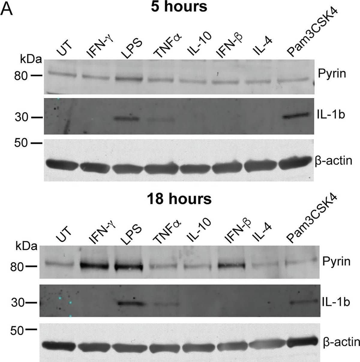 LPS, type I and type II interferons increase Pyrin expression and enable Pyrin activation in human macrophages.(A) Pyrin and IL-1 beta  expression in hMDM treated with either IFN-gamma  (200 U/ml), LPS (10 ng/ml), TNF alpha  (50 ng/ml), IL-10 (100 ng/ml), IFN-beta  (5,000 U/ml), IL-4 (1,000 U/ml), or Pam3CSK4 (20 ng/ml) for either 5 or 18 h. Representative of 3 independent experiments. (B) Pyrin (MEFV) or IL-1 beta  (IL1 beta ) transcript from hMDM-treated LPS (10 ng/ml) or Pam3CSK4 (20 ng/ml) for 12 h. Mean and SEM of the fold change of 3 experimental replicates shown. The underlying data can be found in the summary data file in the tab Fig 5B. Image collected and cropped by CiteAb from the following open publication (//pubmed.ncbi.nlm.nih.gov/36342970), licensed under a CC-BY license. Not internally tested by R&D Systems.