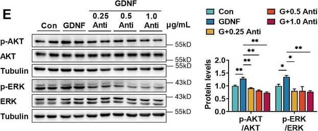 Glial cell line-derived neurotrophic factor (GDNF)-induced claudin-5 & VE-cadherin expression in hCMEC/D3  by activating the PI3K/AKT & MAPK/ERK signaling.(A) Effects of 3 μM LY294002 (LY) on levels of claudin-5, VE-cadherin, & p-AKT/AKT in hCMEC/D3  stimulated by 200 pg/ml GDNF. (B) Effects of 2 μM U0126 (U0) on levels of claudin-5, VE-cadherin, & p-ERK/ERK in hCMEC/D3  stimulated by 200 pg/ml GDNF. (C) Effects of 5 μM SP600125 (SP) on levels of claudin-5, VE-cadherin, & p-JNK/JNK in hCMEC/D3  stimulated by 200 pg/ml GDNF. (D) Effects of 2 μM SB203580 (SB) on levels of claudin-5, VE-cadherin, & p-p38/p38 in hCMEC/D3  stimulated by 200 pg/ml GDNF. (E) Effects of anti-GDNF antibody on GDNF-induced p-AKT/AKT & p-ERK/ERK ratios. (F) Effects of 3 μM LY on levels of claudin-5, VE-cadherin, & p-AKT/AKT in hCMEC/D3  stimulated by US-CM. (G) Effects of 2 μM U0 on levels of claudin-5, VE-cadherin, & p-ERK/ERK in hCMEC/D3  stimulated by US-CM. (H) Effects of 5 μM SP on levels of claudin-5, VE-cadherin, & p-JNK/JNK in hCMEC/D3  stimulated by US-CM. (I) Effects of 2 μM SB on levels of claudin-5, VE-cadherin, & p-p38/p38 in hCMEC/D3  stimulated by US-CM. (J) Effects of anti-GDNF antibody on US-CM-induced p-AKT/AKT & p-ERK/ERK ratios. The above data are shown as the mean ± SEM. Four biological replicates per group. One technical replicate per biological replicate. *p < 0.05; **p < 0.01 by one-way ANOVA test followed by Fisher’s LSD test or Welch’s ANOVA test. Figure 3—source data 1.The WB raw images in Figure 3.Figure 3—source data 2.The labeled WB images in Figure 3.Figure 3—source data 3.Excel file containing summary data & data analysis of Figure 3.The WB raw images in Figure 3.The labeled WB images in Figure 3.Excel file containing summary data & data analysis of Figure 3. Image collected & cropped by CiteAb from the following open publication (//elifesciences.org/articles/96161), licensed under a CC-BY license. Not internally tested by R&D Systems.