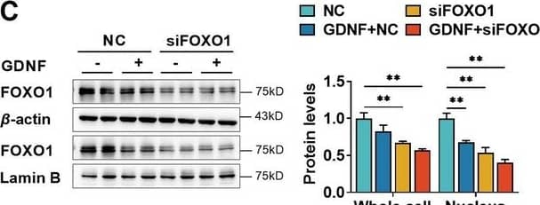 Glial cell line-derived neurotrophic factor (GDNF) induced the claudin-5 expression in hCMEC/D3 cells by activating the PI3K/AKT/FOXO1 pathway. The expression levels of total and nuclear FOXO1 (C) in hCMEC/D3 cells transfected with FOXO1 siRNA (siFOXO1). NC: negative control. Image collected and cropped by CiteAb from the following open publication (//elifesciences.org/articles/96161), licensed under a CC-BY license. Not internally tested by R&D Systems.