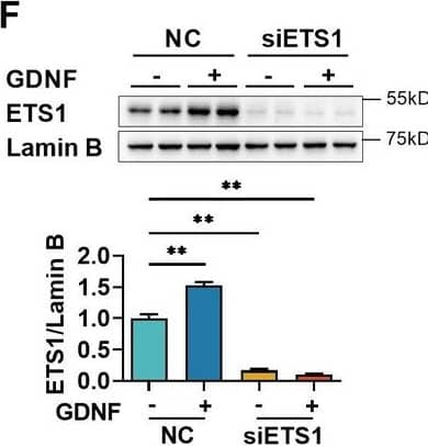 Glial cell line-derived neurotrophic factor (GDNF)-induced VE-cadherin expression in hCMEC/D3 cells by activating the PI3K/AKT/ETS1 and MAPK/ERK/ETS1 pathways. Effects of US-CM and GDNF on total (A) and nuclear (B) ETS1 expression. Effects of LY and U0 on 200 pg/ml GDNF-induced total (C) and nuclear (D) ETS1 expression. Expression levels of total (E) and the nuclear ETS1 (F) in hCMEC/D3 cells after knocking down ETS1 with siRNA (siETS1). (G) Effects of GDNF and siETS1 on the expression of VE-cadherin and claudin-5. The above data are shown as the mean ± SEM. Four biological replicates per group. One technical replicate for each biological replicate. *p < 0.05; **p < 0.01 by one-way ANOVA test followed by Fisher’s LSD test. Figure 5—source data 1.The western blot raw images in Figure 5.Figure 5—source data 2.The labeled western blot images in Figure 5.Figure 5—source data 3.Excel file containing summary data and data analysis of Figure 5.The western blot raw images in Figure 5.The labeled western blot images in Figure 5.Excel file containing summary data and data analysis of Figure 5. Image collected and cropped by CiteAb from the following open publication (//elifesciences.org/articles/96161), licensed under a CC-BY license. Not internally tested by R&D Systems.