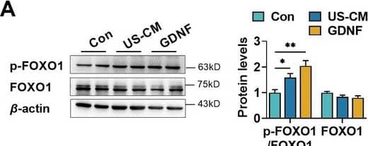 Glial cell line-derived neurotrophic factor (GDNF) induced the claudin-5 expression in hCMEC/D3 cells by activating the PI3K/AKT/FOXO1 pathway. Effects of US-CM and GDNF on the phosphorylated FOXO1 (p-FOXO1)/FOXO1 ratio, total FOXO1 expression (A). Image collected and cropped by CiteAb from the following open publication (//elifesciences.org/articles/96161), licensed under a CC-BY license. Not internally tested by R&D Systems.