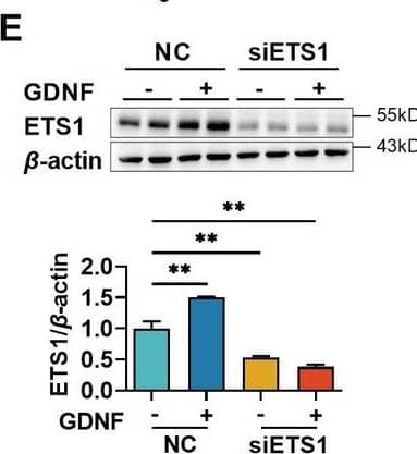 Glial cell line-derived neurotrophic factor (GDNF)-induced VE-cadherin expression in hCMEC/D3 cells by activating the PI3K/AKT/ETS1 and MAPK/ERK/ETS1 pathways. Effects of US-CM and GDNF on total (A) and nuclear (B) ETS1 expression. Effects of LY and U0 on 200 pg/ml GDNF-induced total (C) and nuclear (D) ETS1 expression. Expression levels of total (E) and the nuclear ETS1 (F) in hCMEC/D3 cells after knocking down ETS1 with siRNA (siETS1). (G) Effects of GDNF and siETS1 on the expression of VE-cadherin and claudin-5. The above data are shown as the mean ± SEM. Four biological replicates per group. One technical replicate for each biological replicate. *p < 0.05; **p < 0.01 by one-way ANOVA test followed by Fisher’s LSD test. Figure 5—source data 1.The western blot raw images in Figure 5.Figure 5—source data 2.The labeled western blot images in Figure 5.Figure 5—source data 3.Excel file containing summary data and data analysis of Figure 5.The western blot raw images in Figure 5.The labeled western blot images in Figure 5.Excel file containing summary data and data analysis of Figure 5. Image collected and cropped by CiteAb from the following open publication (//elifesciences.org/articles/96161), licensed under a CC-BY license. Not internally tested by R&D Systems.