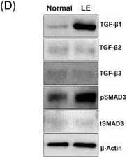 BCRL results in increased TGF‐ beta 1 expression and signaling. (A) Representative IF localisation of TGF‐ beta 1 (top) and pSMAD3 (bottom) in normal and lymphedematous (labelled LE) tissues. (B) Quantification of TGF‐ beta 1 (top) and pSMAD3 (bottom) IF staining areas in tissue sections of patients with unilateral BCRL. Each circle represents an average of three HPF views per patient (N = 8). (C) mRNA expression of TGF‐ beta  isoforms and TGF‐ beta RI comparing normal and lymphedematous limb of patients with unilateral BCRL. Each circle represents an individual patient (N = 14). (D) Representative Western blot of TGF‐ beta  isoforms, pSMAD3 and tSMAD3 in normal and lymphedematous limbs of patients with unilateral BCRL. (E) Quantification of Western blots with relative changes comparing normal and lymphedematous limb of each patient. Each circle represents an average of two separate Western blots per patient (N = 8). BCRL, breast cancer‐related lymphedema; TGF‐ beta 1, transforming growth factor‐beta 1; IF, immunofluorescence; LE, lymphedema; HPF, high‐power field; TGF‐ beta R‐I, transforming growth factor‐beta receptor I Image collected and cropped by CiteAb from the following open publication (//pubmed.ncbi.nlm.nih.gov/35652284), licensed under a CC-BY license. Not internally tested by R&D Systems.