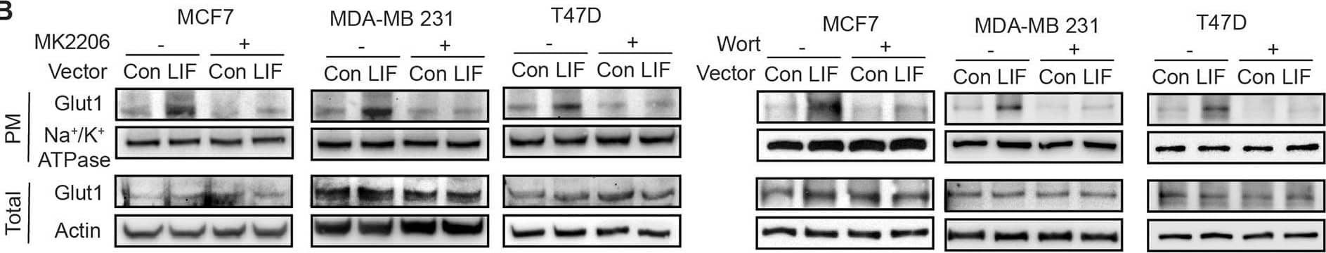 LIF promotes Glut1 PM translocation through the activation of AKT signaling.A LIF activated the AKT signaling, which can be blocked by MK2206, an AKT inhibitor (upper panel), or Wortmannin (Wort), a PI3K inhibitor (lower panel), in MCF7, MDA-MB 231 and T47D cells. The levels of p-AKTSer473 (p-AKT), which reflect the activity of AKT were measured by Western-blot assays. B Blocking AKT signaling by MK2206 (left) or Wortmannin (right) largely abolished the promoting effect of LIF on Glut1 PM translocation in breast cancer cells. C, D Blocking AKT signaling by expression of dominant-negative AKT (AKT-DN) largely abolished the promoting effect of LIF on Glut1 PM translocation in breast cancer cells. Cells were transfected with vectors expressing AKT-DN. The levels of p-AKT and total AKT (C), as well as Glut1 PM translocation (D), were determined by Western-blot assays. Uncropped Western-blot images are shown in Supplementary Fig 3. Image collected and cropped by CiteAb from the following open publication (//pubmed.ncbi.nlm.nih.gov/35440095), licensed under a CC-BY license. Not internally tested by R&D Systems.