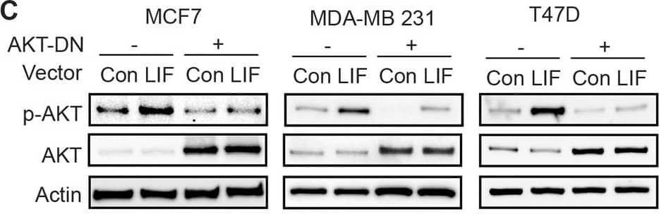 LIF promotes Glut1 PM translocation through the activation of AKT signaling.A LIF activated the AKT signaling, which can be blocked by MK2206, an AKT inhibitor (upper panel), or Wortmannin (Wort), a PI3K inhibitor (lower panel), in MCF7, MDA-MB 231 and T47D cells. The levels of p-AKTSer473 (p-AKT), which reflect the activity of AKT were measured by Western-blot assays. B Blocking AKT signaling by MK2206 (left) or Wortmannin (right) largely abolished the promoting effect of LIF on Glut1 PM translocation in breast cancer cells. C, D Blocking AKT signaling by expression of dominant-negative AKT (AKT-DN) largely abolished the promoting effect of LIF on Glut1 PM translocation in breast cancer cells. Cells were transfected with vectors expressing AKT-DN. The levels of p-AKT and total AKT (C), as well as Glut1 PM translocation (D), were determined by Western-blot assays. Uncropped Western-blot images are shown in Supplementary Fig 3. Image collected and cropped by CiteAb from the following open publication (//pubmed.ncbi.nlm.nih.gov/35440095), licensed under a CC-BY license. Not internally tested by R&D Systems.