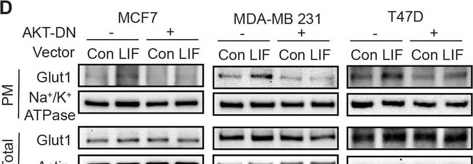 LIF promotes Glut1 PM translocation through the activation of AKT signaling.A LIF activated the AKT signaling, which can be blocked by MK2206, an AKT inhibitor (upper panel), or Wortmannin (Wort), a PI3K inhibitor (lower panel), in MCF7, MDA-MB 231 and T47D cells. The levels of p-AKTSer473 (p-AKT), which reflect the activity of AKT were measured by Western-blot assays. B Blocking AKT signaling by MK2206 (left) or Wortmannin (right) largely abolished the promoting effect of LIF on Glut1 PM translocation in breast cancer cells. C, D Blocking AKT signaling by expression of dominant-negative AKT (AKT-DN) largely abolished the promoting effect of LIF on Glut1 PM translocation in breast cancer cells. Cells were transfected with vectors expressing AKT-DN. The levels of p-AKT and total AKT (C), as well as Glut1 PM translocation (D), were determined by Western-blot assays. Uncropped Western-blot images are shown in Supplementary Fig 3. Image collected and cropped by CiteAb from the following open publication (//pubmed.ncbi.nlm.nih.gov/35440095), licensed under a CC-BY license. Not internally tested by R&D Systems.