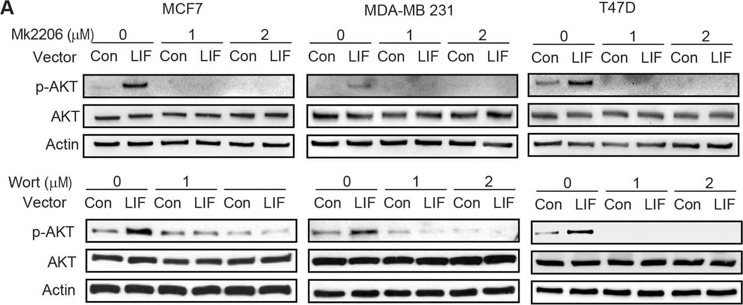 LIF promotes Glut1 PM translocation through the activation of AKT signaling.A LIF activated the AKT signaling, which can be blocked by MK2206, an AKT inhibitor (upper panel), or Wortmannin (Wort), a PI3K inhibitor (lower panel), in MCF7, MDA-MB 231 and T47D cells. The levels of p-AKTSer473 (p-AKT), which reflect the activity of AKT were measured by Western-blot assays. B Blocking AKT signaling by MK2206 (left) or Wortmannin (right) largely abolished the promoting effect of LIF on Glut1 PM translocation in breast cancer cells. C, D Blocking AKT signaling by expression of dominant-negative AKT (AKT-DN) largely abolished the promoting effect of LIF on Glut1 PM translocation in breast cancer cells. Cells were transfected with vectors expressing AKT-DN. The levels of p-AKT and total AKT (C), as well as Glut1 PM translocation (D), were determined by Western-blot assays. Uncropped Western-blot images are shown in Supplementary Fig 3. Image collected and cropped by CiteAb from the following open publication (//pubmed.ncbi.nlm.nih.gov/35440095), licensed under a CC-BY license. Not internally tested by R&D Systems.