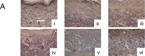 Immunohistochemical detection of KGF-2 in biopsies of DNCB-induced rashes treated with various nanocrystalline silver-derived solutions. (A) Representative images are shown for immunohistochemical detection of KGF-2 after 24 h treatment of negative controls with distilled water (i), and DNCB-induced porcine contact dermatitis rashes with distilled water (positive controls) (ii), or nanocrystalline silver-derived solutions generated at starting pHs of 4 (iii), 5.6 (iv), 7 (v), or 9 (vi). The scale bar in A represents 100 μm. Staining for KGF-2 appears brown, while the cell nuclei are counterstained purple using haematoxylin. Immunohistochemical staining scores for KGF-2 are shown after 24 h (B) and 72 h (C) of treatment as described above. Statistical analyses, which were performed using one-way ANOVAs with Tukey-Kramer Multiple Comparisons post tests, are shown in Table 4. Error bars represent standard deviations. Image collected and cropped by CiteAb from the following open publication (//pubmed.ncbi.nlm.nih.gov/20170497), licensed under a CC-BY license. Not internally tested by R&D Systems.