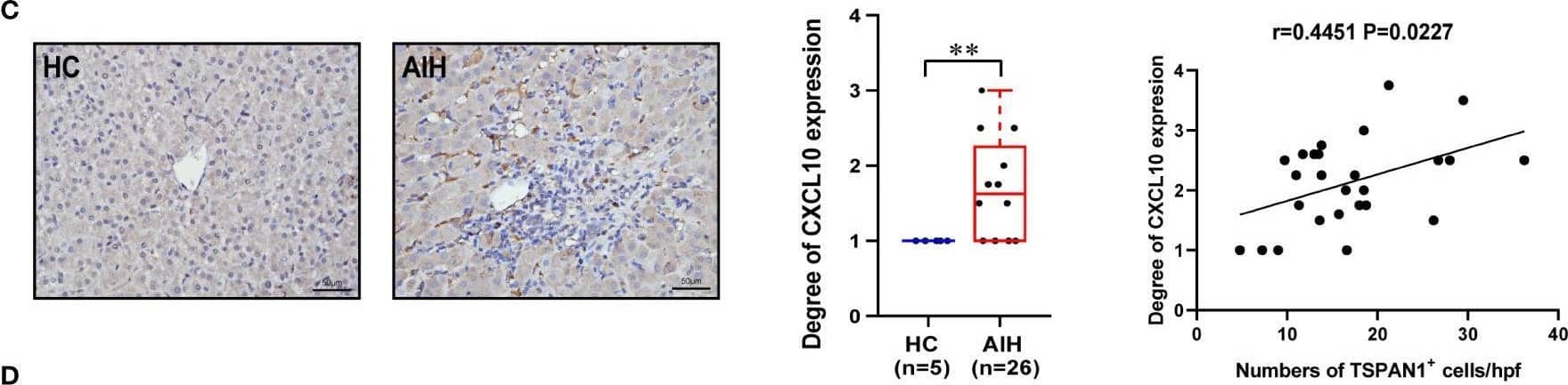 The expression of CXCR3 and CXCL10 in AIH. (A) Multiplex immunofluorescence staining of CXCR3 (red), CD19 (yellow), and TSPAN1 (green) in the liver of AIH patients. (B) Representative confocal staining of TSPAN1 and CXCL10 in the livers of AIH. (C) Immunohistochemical staining of CXCL10 in AIH and HC (×400). Correlation analysis of hepatic CXCL10 expression degree with the numbers of TSPAN1. (D) CD19+ B cells were placed in the upper chambers and complete medium was added in the lower chambers with rhCXCL10 (3 μg/mL) or not for 6 hours. The percentage of TSPAN1+ cells was measured by flow cytometry. Boxes represent the 25th–75th percentile of the distribution; the median is shown as a thick line in the middle of the box; whiskers extend to values with 1.5 times the difference between the 25th and 75th percentiles. *P < 0.05, **P < 0.01. Image collected and cropped by CiteAb from the following open publication (//pubmed.ncbi.nlm.nih.gov/36591302), licensed under a CC-BY license. Not internally tested by R&D Systems.