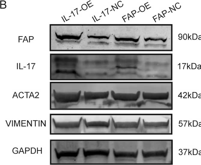 IL-17 upregulates FAP expression by activating the p-STAT3 signaling pathway.A Protein levels of FAP, pSTAT3 (Tyr705), pSTAT3 (Ser727), and STAT3 after 20 ng/ml IL-17a stimulation or PBS treatment. B Protein levels of FAP, IL-17, ACTA2, and VIMENTIN in IL-17-OE cells, FAP-OE cells, and the corresponding negative control cell lines. C Protein levels of pSTAT3 (Tyr705), pSTAT3 (Ser727), STAT3, pP65, and P65 in IL-17-OE cells, FAP-OE cells, and the corresponding negative control cell lines. D The binding ability of pSTAT3 (Tyr705) and STAT3 to the FAP promoter region in FAP-OE and FAP-NC cells was evaluated by a CUT&RUN assay. E The binding ability of pSTAT3 (Tyr705) and STAT3 to the FAP promoter region in IL-17-OE and IL-17-NC cells was evaluated by a CUT&RUN assay. F The mRNA expression of FAP of LX2 cell line after 24 h treatment of 50 μg/mL Colivelin. G The expression of FAP, STAT3, and p-STAT3 in LX2 cell line after 24 h treatment of 50 μg/mL Colivelin. H The FAP, STAT3, p-STAT3 level in FAP-OE and FAP-NC cell lines after 2 μM HJC0152 treatment. Image collected and cropped by CiteAb from the following open publication (//www.nature.com/articles/s41420-024-01995-4), licensed under a CC-BY license. Not internally tested by R&D Systems.