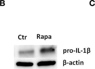 Rapamycin increases pro-IL-1 beta  protein levels, rescues serum starvation-induced pro-IL-1 beta  degradation, inhibits mTOR but induces no autophagy in LPS-stimulated cardiac fibroblasts. (A) IL-1 beta  release was quantified in conditioned media from cardiac fibroblasts primed with 10 ng/mL LPS for 20 h with or without 500 nM rapamycin, as indicated, prior to activation with 3 mM ATP for 60 min. (B,C) Fibroblasts were primed with 10 ng/mL LPS for 20 h with or without 500 nM rapamycin and pro-IL-1 beta  western blot performed (n = 3). (D,E) Control cells were incubated with 10% FCS, while serum deprived cells were incubated with or without 500 nM Rapamycin. Protein expressions were quantified with western blot (n = 4) (F,G). IL-1 beta  and TNF-alpha  were quantified in conditioned media from cardiac fibroblasts incubated with or without 10% FCS and 500 nM rapamycin and stimulated with LPS 10 ng/mL for 20 h prior to activation with 3 mM ATP for 60 min as indicated (n = 6) (H,I) IL-1 beta  and TNF mRNA were quantified with PCR. (J–L) Cardiac fibroblasts were incubated with 10% FCS with or without 10 ng/mL LPS and/or 500 nM rapamycin for 20 h and mTOR (K) and p70 S6 kinase (L) activity were quantified with western blot (n = 5). (M,N) Cardiac fibroblasts primed with LPS (10 ng/mL) were incubated with 10% FCS (control) or no serum for 4 h. Cells were labeled with anti-LC3B and Hoechst and whole slides scanned with an automated immunofluorescence microscope. LC3B puncta in all cells in were automatically counted and ratio to number of Hoechst-labeled kernels calculated. Columns are mean with SEM of paired data normalized to control = 1 (n = 5). (O) Cardiac fibroblasts were incubated with 10% FCS, 10 ng/mL LPS, and/or 5 mM 3-methyladenine (3-MA) for 18 h and/or ATP 3 mM for 60 min as indicated (n = 3). Rapa: rapamycin. 3-MA: 3-methyladenine, ns: not significant, *p < 0.05, **p < 0.01, ****p < 0.0001 (paired student t-test). Image collected and cropped by CiteAb from the following publication (//pubm