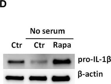 Rapamycin increases pro-IL-1 beta  protein levels, rescues serum starvation-induced pro-IL-1 beta  degradation, inhibits mTOR but induces no autophagy in LPS-stimulated cardiac fibroblasts. (A) IL-1 beta  release was quantified in conditioned media from cardiac fibroblasts primed with 10 ng/mL LPS for 20 h with or without 500 nM rapamycin, as indicated, prior to activation with 3 mM ATP for 60 min. (B,C) Fibroblasts were primed with 10 ng/mL LPS for 20 h with or without 500 nM rapamycin and pro-IL-1 beta  western blot performed (n = 3). (D,E) Control cells were incubated with 10% FCS, while serum deprived cells were incubated with or without 500 nM Rapamycin. Protein expressions were quantified with western blot (n = 4) (F,G). IL-1 beta  and TNF-alpha  were quantified in conditioned media from cardiac fibroblasts incubated with or without 10% FCS and 500 nM rapamycin and stimulated with LPS 10 ng/mL for 20 h prior to activation with 3 mM ATP for 60 min as indicated (n = 6) (H,I) IL-1 beta  and TNF mRNA were quantified with PCR. (J–L) Cardiac fibroblasts were incubated with 10% FCS with or without 10 ng/mL LPS and/or 500 nM rapamycin for 20 h and mTOR (K) and p70 S6 kinase (L) activity were quantified with western blot (n = 5). (M,N) Cardiac fibroblasts primed with LPS (10 ng/mL) were incubated with 10% FCS (control) or no serum for 4 h. Cells were labeled with anti-LC3B and Hoechst and whole slides scanned with an automated immunofluorescence microscope. LC3B puncta in all cells in were automatically counted and ratio to number of Hoechst-labeled kernels calculated. Columns are mean with SEM of paired data normalized to control = 1 (n = 5). (O) Cardiac fibroblasts were incubated with 10% FCS, 10 ng/mL LPS, and/or 5 mM 3-methyladenine (3-MA) for 18 h and/or ATP 3 mM for 60 min as indicated (n = 3). Rapa: rapamycin. 3-MA: 3-methyladenine, ns: not significant, *p < 0.05, **p < 0.01, ****p < 0.0001 (paired student t-test). Image collected and cropped by CiteAb from the following publication (//pubm