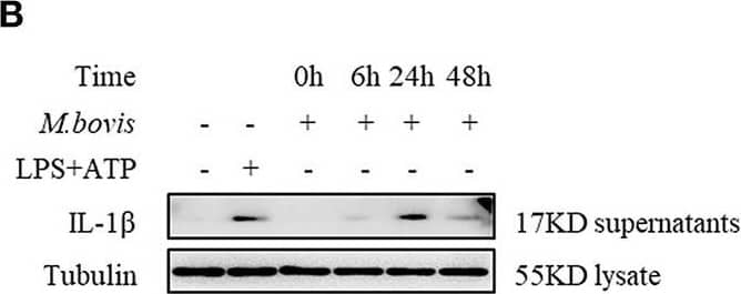 <b>Biological Strategies Validation. </b>M. bovis-induced inflammasome activation requires ERS. (A) Immunoblot analysis at different time-points of Bip and p-IRE1 alpha  in lysates of BMDMs infected with M. bovis (MOI 10). (B) Immunoblot analysis at different time-points of IL-1 beta  in supernatants of BMDMs infected with M. bovis (MOI 10). (C) ELISA for IL-1 beta  analysis from supernatants of BMDMs infected with M. bovis (MOI 10). (D) IL-1 beta  immunoblot analysis of supernatants from BMDM infected for 24 h with M. bovis (MOI 10) in the presence or absence of 4-PBA. (E) ELISA for IL-1 beta  quantification from supernatants of BMDMs treated with or without 4-PBA for 1 h and then infected with M. bovis (MOI 10) for 24 h. ELISA for (F) TNF-  alpha  and (G) IL-6 detection in supernatants from M. bovis (MOI 10) infected BMDMs. ELISA for (H) TNF-alpha  and (I) IL-6 detection from supernatants of BMDMs treated with or without 4-PBA for 1 h and then infected with M. bovis (MOI 10) for 24 h. TM, tunicamycin, positive control for ERS induced mitochondrial damage, 10 μg/mL; LPS+ATP, positive control for inflammasome activation, 200 ng/mL, and 1 mM, respectively; LPS, positive control for TNF-alpha  and IL-6 production, 200 ng/mL; UNT, untreated; 4-PBA, 4-phenyl butyric acid, ERS inhibitor, 5 mM; MOI, multiplicity of infection. For (C,F,G), Data are representative of at least three independent experiments, each performed in triplicate for WB. The results are shown are the mean ± SD. The asterisks indicate statistically significant differences compared with untreated cells (*P < 0.05, **P < 0.01, ***P < 0.001, n.s., not significant). P-values were obtained by using one-way ANOVA followed by post-hoc Turkey' comparison test. For (E,H,I), data are representative of at least three independent experiments. The results are shown as the mean ± SD. *P < 0.05, **P < 0.01, ***P < 0.001, n.s., not significant. P-values were analyzed using Student's t-test. Image collected and cropped by CiteAb from the following publication (//pubmed.ncbi.nlm.nih.gov/30846986)