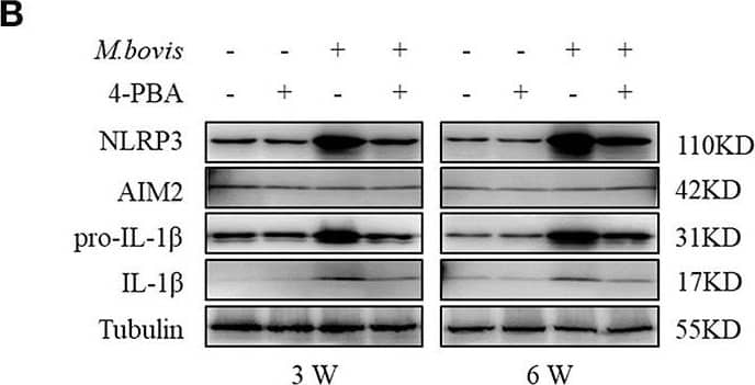 <b>Biological Strategies Validation. </b>ERS mediates M. bovis-induced inflammasome activation in vivo. (A) ELISA detection of IL-1 beta  in serum samples from C57BL/6 mice treated with or without 4-PBA (18.6 mg/mouse/day) and infected with M. bovis (CFU 200) (n = 7). (B) Immunoblot analysis of NLRP3, AIM2, pro-IL-1 beta , and IL-1 beta  in the lung tissues of M. bovis-infected mice in the presence or absence of 4-PBA. (C,D) Pathological lesions (H&E staining) in the lung of mice infected with M. bovis for 3 weeks (C) or 6 weeks (D) in the presence or absence of 4-PBA (18.6 mg/mouse/day) (n = 3). 4-PBA, 4-phenyl butyric acid, ERS inhibitor, 18.6 mg/mouse/day; CFU, colony forming units (n = 3). The results are shown as the mean ± SD. ***P < 0.001, n.s., not significant. P-values were analyzed by using Student's t-test (C,D). Scale bar = 100 μm. Image collected and cropped by CiteAb from the following publication (//pubmed.ncbi.nlm.nih.gov/30846986), licensed under a CC-BY license. Not internally tested by R&D Systems.