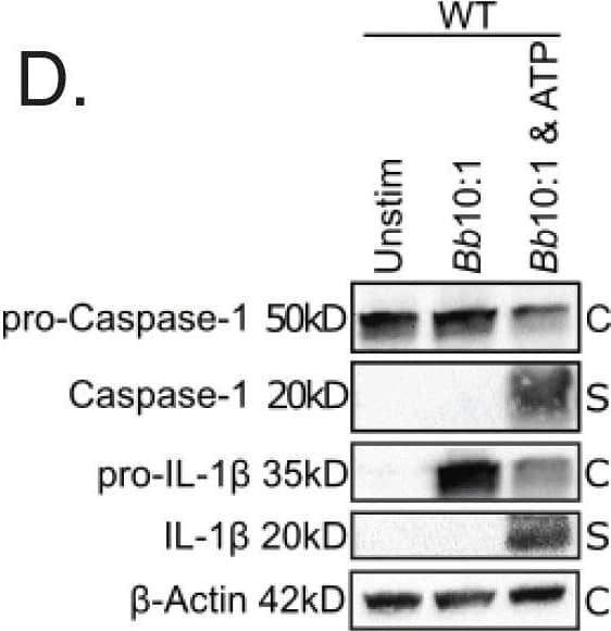 Colocalization of phagosome markers with internalized Bb in WT and MyD88−/− BMDMs. a-b Confocal 40x images of WT (a) and MyD88−/− (b) BMDMs after 6 h stimulation with Bb at MOI 10:1, depicting colocalization of Bb-containing phagosomes with LAMP-1. White box indicates phagosome depicted in inset. Graph shows the intensity of each indicated pixel across the white line (distance on x-axis). Green is Bb, red is LAMP-1 and yellow is actin. c Quantitation of colocalization between Bb and LAMP-1 in 10 phagosomes of WT (black dots) and MyD88−/− (red dots) BMDMs by measuring intensity difference between LAMP-1 staining and Bb staining. d Western blot of protein lysate isolated from WT BMDMs after 6 h stimulation with Bb +/− ATP (C = cell lysate, S = supernatant) Image collected and cropped by CiteAb from the following publication (//pubmed.ncbi.nlm.nih.gov/34000990), licensed under a CC-BY license. Not internally tested by R&D Systems.
