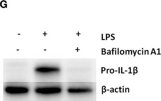 Pro-IL-1 beta  degradation is induced by the autophagy inhibitors chloroquine and bafilomycin A, and by the proteasome activator betulinic acid. (A) Chloroquine selectively attenuates IL-1 beta  release from cardiac fibroblasts. The cells were incubated with LPS and/or 20 μM chloroquine phosphate as indicated for 18 h, then activated with 3 mM ATP for 60 min. IL-1 beta , TNF, MIP-2, and IL-6 were quantified in the conditioned media (n = 3). (B,C) Cardiac fibroblasts were incubated with LPS for 18 h with or without 20 μM chloroquine phosphate and pro-IL-1 beta  quantified with western blot (n = 3). (D) Pro-IL-1 beta  mRNA expression was quantified with qPCR (n = 3). (E,F) Cardiac fibroblasts were incubated with LPS for 20 h with or without 10% FCS or 20 μM chloroquine phosphate as indicated. The amount of total ubiquitinated protein was quantified with western blot (n = 4). (G,H) Cardiac fibroblasts were incubated with 10% FCS with or without 10 ng/mL LPS and/or 100 nM bafilomycin A1 for 20 h. Pro-IL-1 beta  was quantified with western blot. (I,J) Cardiac fibroblasts were incubated with 10% FCS with or without 10 ng/mL LPS and/or 20 μM betulinic acid as indicated for 20 h. Pro-IL-1 beta  was quantified with western blot. All columns are mean with SEM. *p < 0.05, **p < 0.01 (paired student t-test). Image collected and cropped by CiteAb from the following publication (//pubmed.ncbi.nlm.nih.gov/31244838), licensed under a CC-BY license. Not internally tested by R&D Systems.